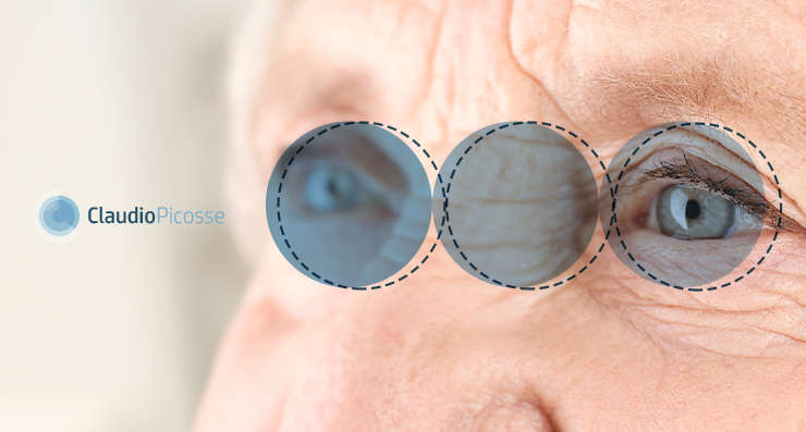  Exames oculares na terceira idade ajudam a identificar risco de demências, como o Alzheimer