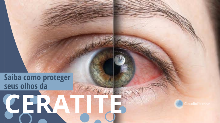  Saiba como proteger seus olhos da CERATITE