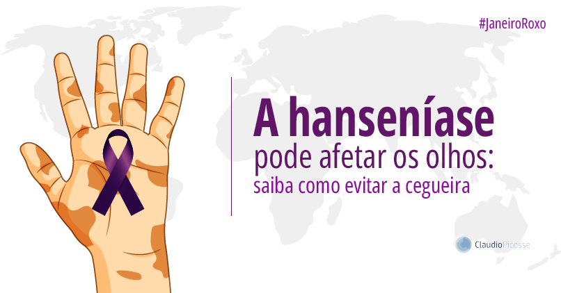 Hanseníase afeta quase 30 mil pessoas por ano no Brasil; saiba se