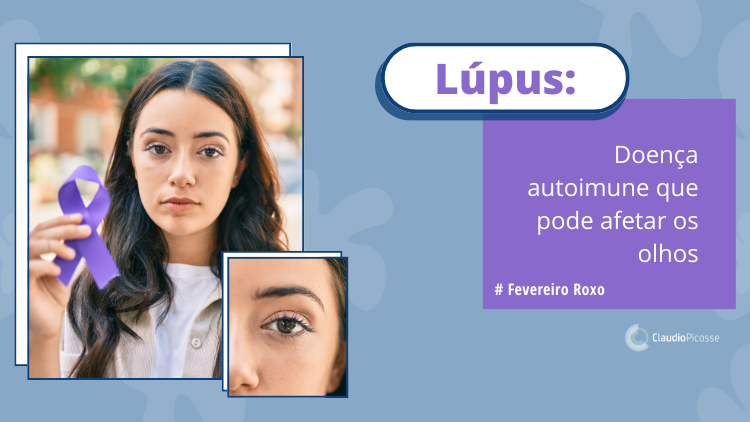  Lúpus: doença autoimune que pode afetar os olhos