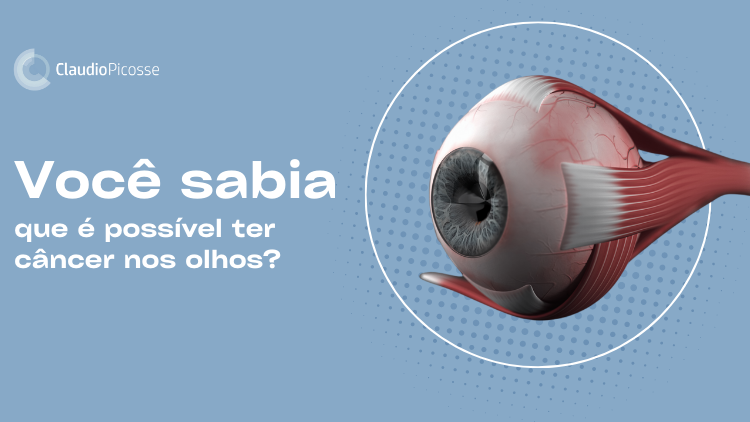  Você sabia que é possível ter câncer nos olhos? Entenda sobre no meu blog!