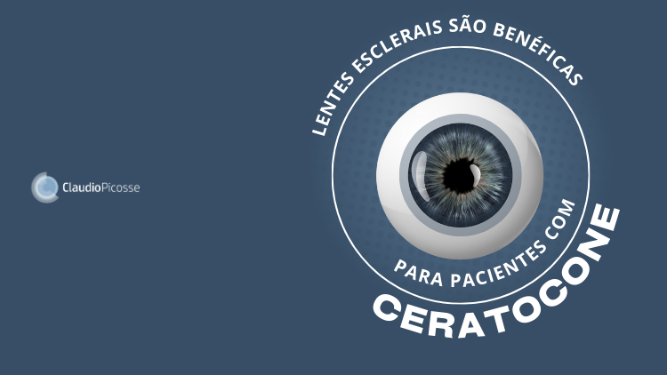  Lentes esclerais são benéficas para pacientes com ceratocone