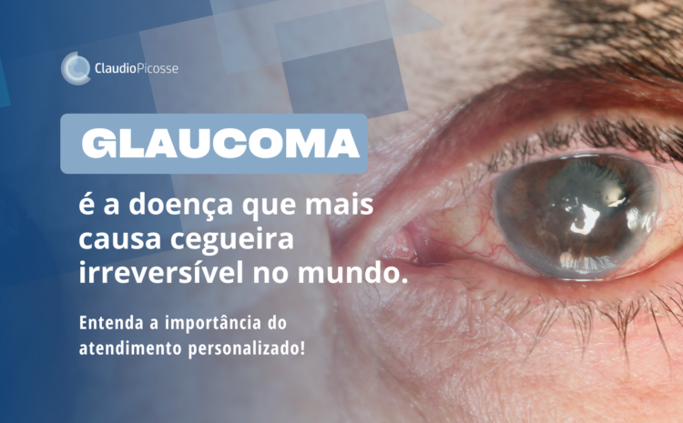  Glaucoma pode causar cegueira: veja a importância do atendimento personalizado