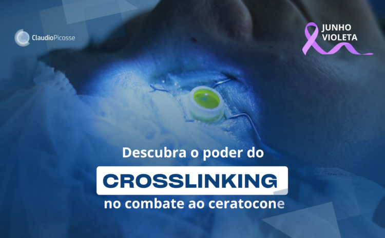  Junho violeta: descubra o poder do crosslinking no combate ao ceratocone