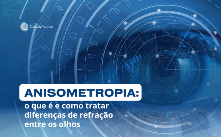  Anisometropia: o que é e como tratar diferenças de refração entre os olhos