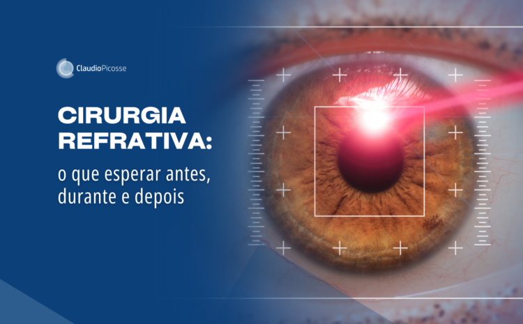  Cirurgia refrativa: o que esperar antes, durante e depois