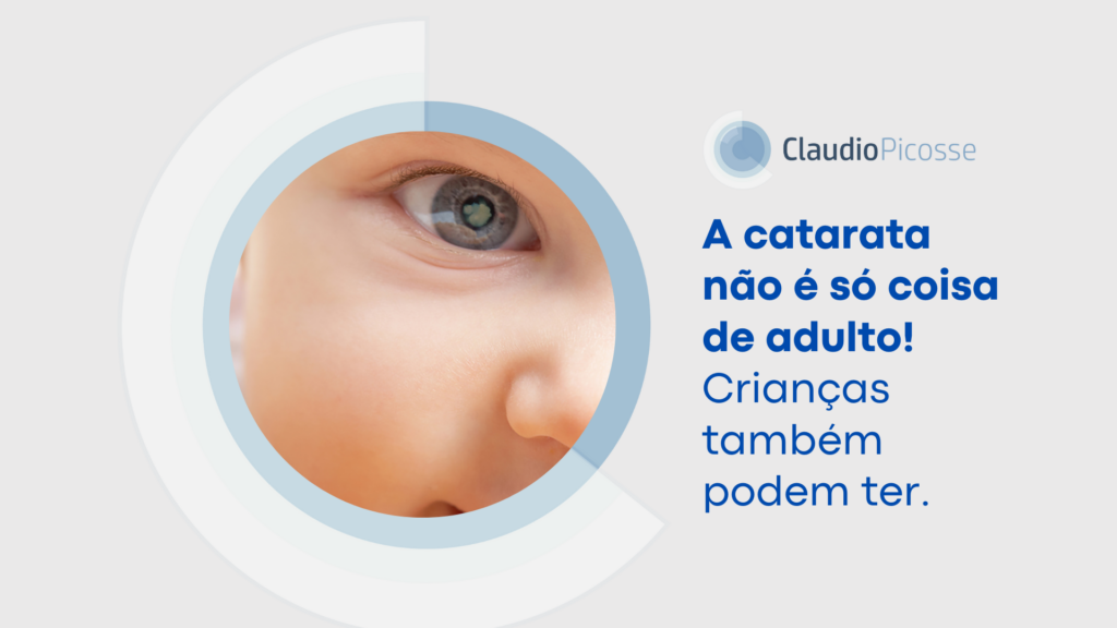 Catarata em crianças: entenda e conheça as opções de tratamento